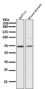 Anti-NF-Kappa B p65 RELA Rabbit Monoclonal Antibody Boster Bio