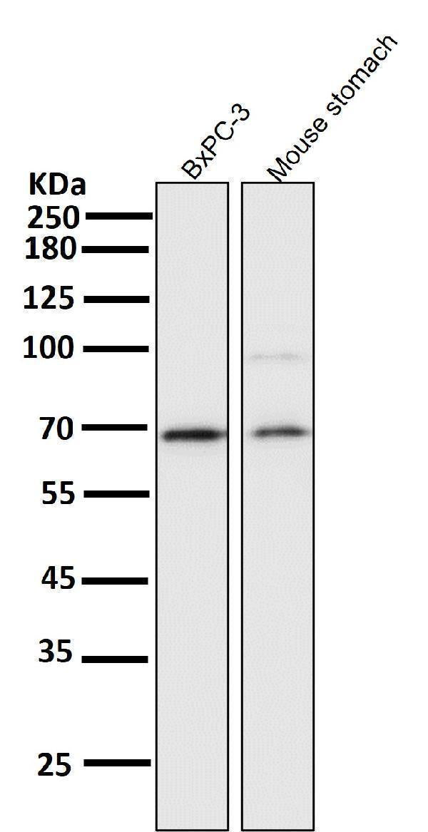 Anti-NF-Kappa B p65 RELA Rabbit Monoclonal Antibody Boster Bio