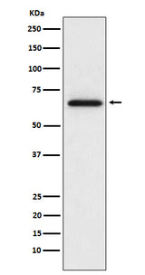 Anti-MMP2 Monoclonal Antibody Boster Bio
