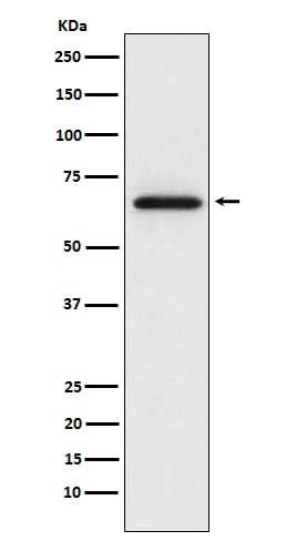 Anti-MMP2 Monoclonal Antibody Boster Bio