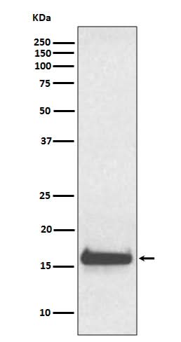 Anti-TTR/Prealbumin Rabbit Monoclonal Antibody Boster Bio