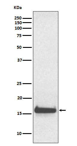Anti-TTR/Prealbumin Rabbit Monoclonal Antibody Boster Bio