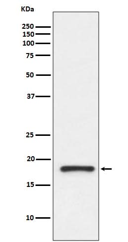 Anti-Prealbumin TTR Rabbit Monoclonal Antibody Boster Bio