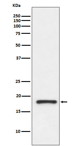 Anti-Prealbumin TTR Rabbit Monoclonal Antibody Boster Bio