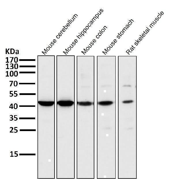 Anti-MEK1 MAP2K1 Rabbit Monoclonal Antibody Boster Bio