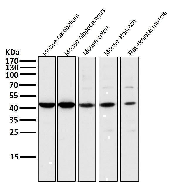 Anti-MEK1 MAP2K1 Rabbit Monoclonal Antibody Boster Bio