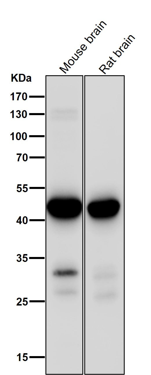 Anti-MEK1 MAP2K1 Rabbit Monoclonal Antibody Boster Bio