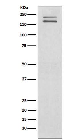 Anti-Ret Rabbit Monoclonal Antibody Boster Bio