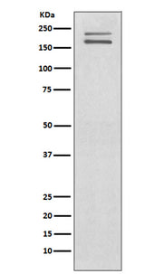 Anti-Ret Rabbit Monoclonal Antibody Boster Bio
