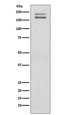 Anti-Ret Rabbit Monoclonal Antibody Boster Bio