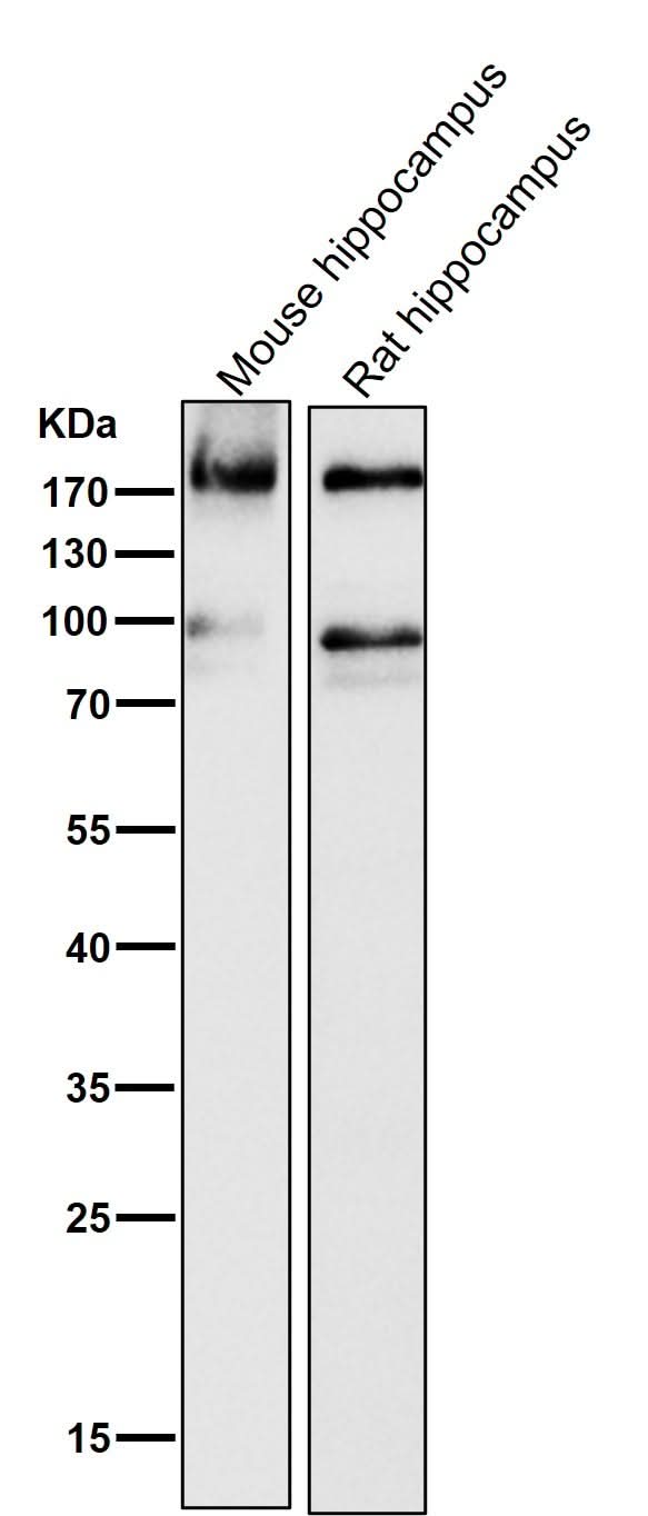 Anti-ErbB4/Her4 Rabbit Monoclonal Antibody Boster Bio