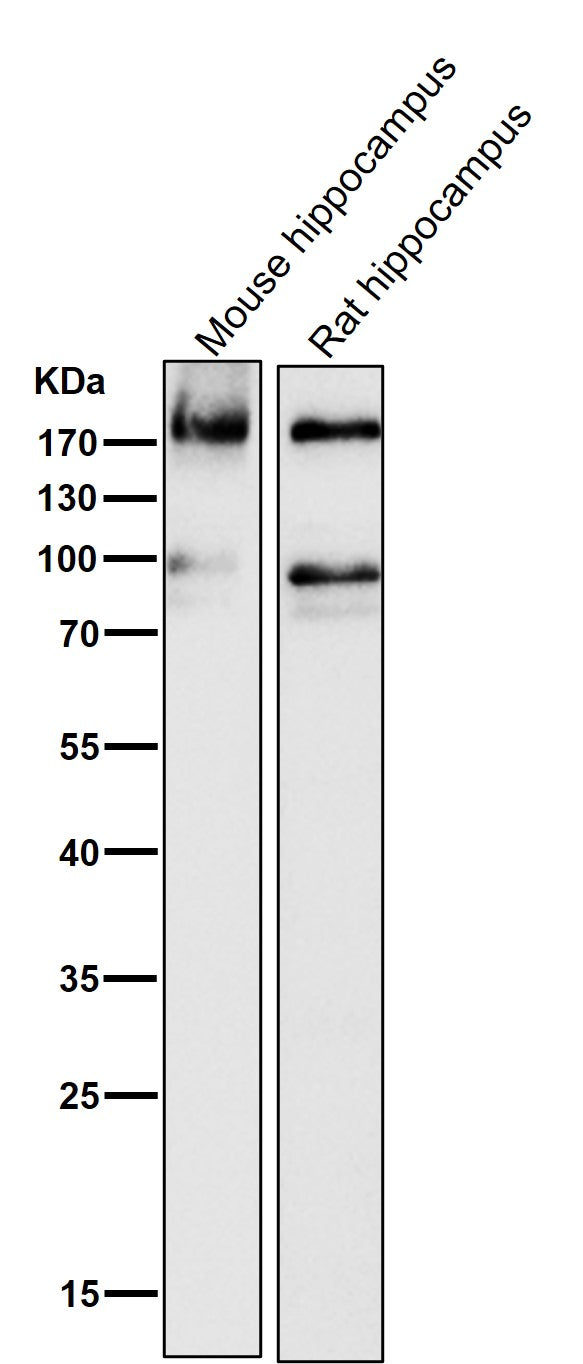 Anti-ErbB4/Her4 Rabbit Monoclonal Antibody Boster Bio