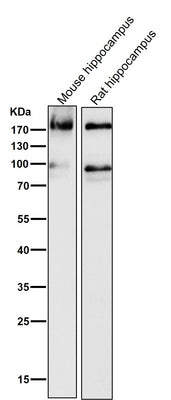 Anti-ErbB4/Her4 Rabbit Monoclonal Antibody Boster Bio