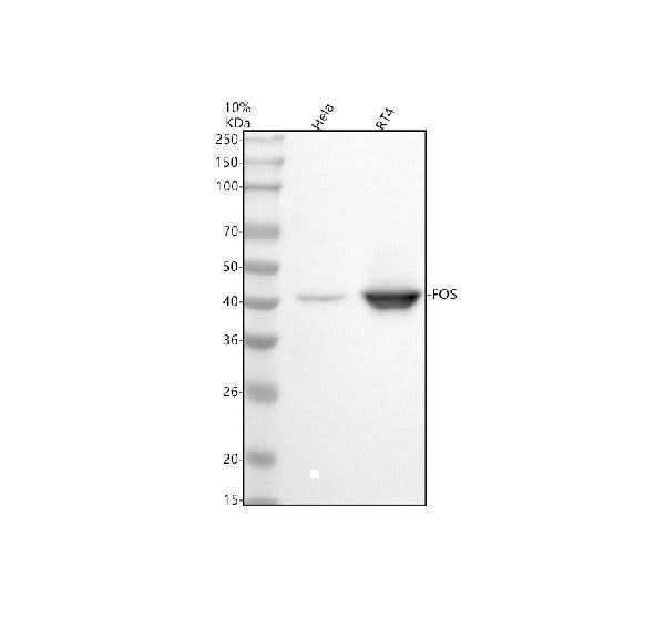 Anti-c-Fos Rabbit Monoclonal Antibody Boster Bio