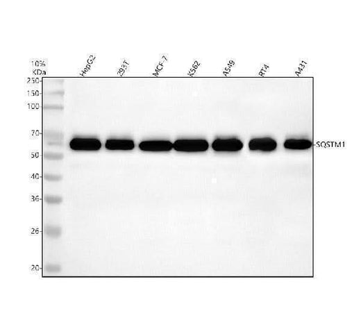 Anti-SQSTM1 / p62 Rabbit Monoclonal Antibody Boster Bio