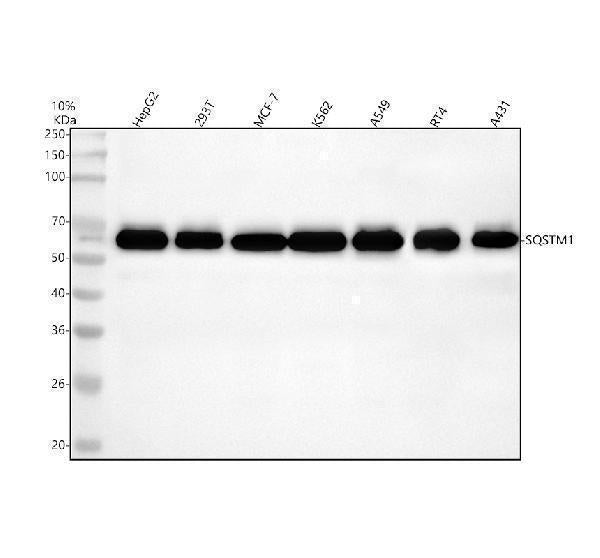 Anti-SQSTM1 / p62 Rabbit Monoclonal Antibody Boster Bio