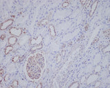 Anti-ALK Rabbit Monoclonal Antibody Boster Bio