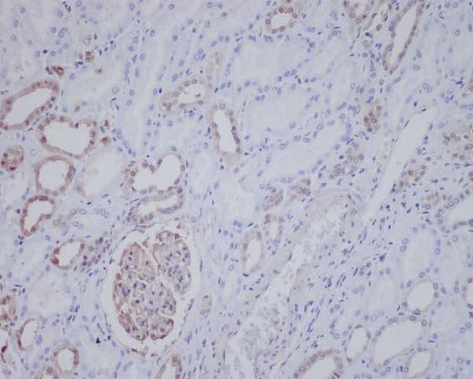 Anti-ALK Rabbit Monoclonal Antibody Boster Bio