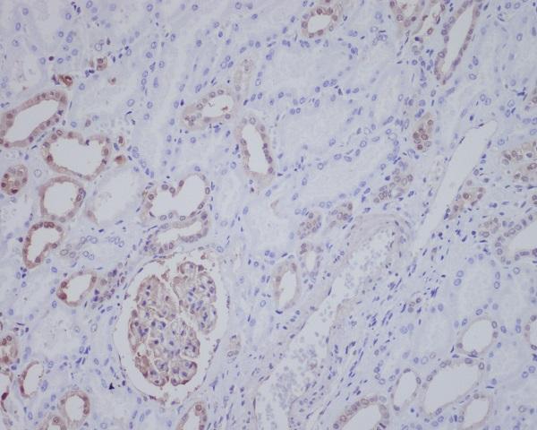 Anti-ALK Rabbit Monoclonal Antibody Boster Bio
