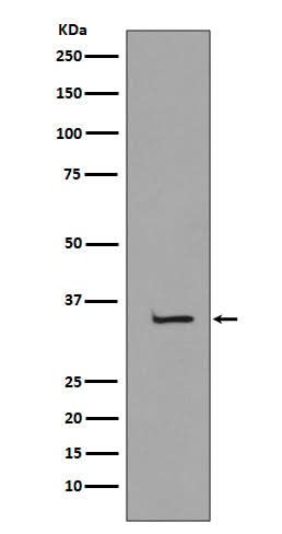 Anti-TBP/Tata Binding Protein Tbp Rabbit Monoclonal Antibody Boster Bio