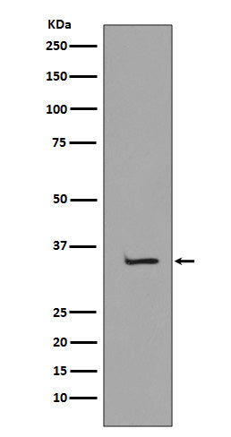 Anti-TBP/Tata Binding Protein Tbp Rabbit Monoclonal Antibody Boster Bio