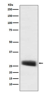 Anti-POMC Monoclonal Antibody Boster Bio