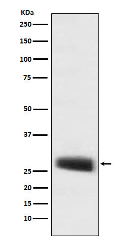 Anti-POMC Monoclonal Antibody Boster Bio