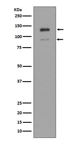 Anti-IFNAR1/Beta R1 Rabbit Monoclonal Antibody Boster Bio