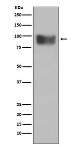 Anti-Interferon Receptor alpha IFNAR1 Rabbit Monoclonal Antibody Boster Bio