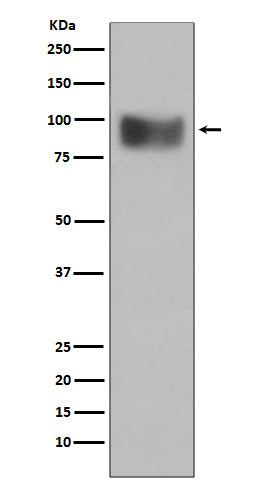 Anti-Interferon Receptor alpha IFNAR1 Rabbit Monoclonal Antibody Boster Bio