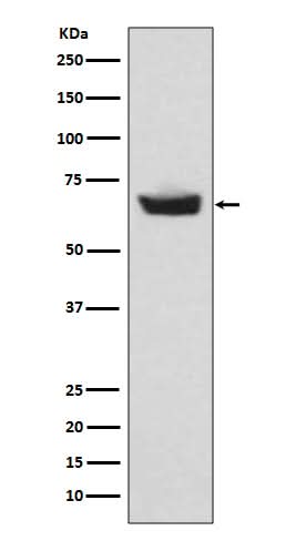 Anti-CETP Rabbit Monoclonal Antibody Boster Bio