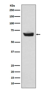 Anti-CETP Rabbit Monoclonal Antibody Boster Bio