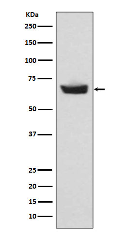 Anti-CETP Rabbit Monoclonal Antibody Boster Bio