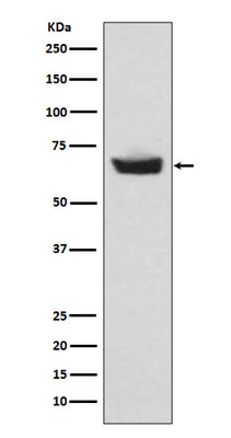 Anti-CETP Rabbit Monoclonal Antibody Boster Bio