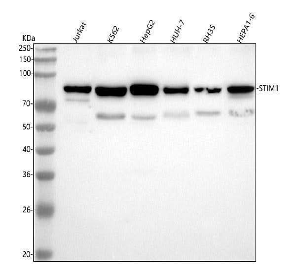 Anti-Stromal interaction molecule 1 STIM1 Rabbit Monoclonal Antibody Boster Bio