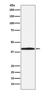 Anti-BGAT Rabbit Monoclonal Antibody Boster Bio