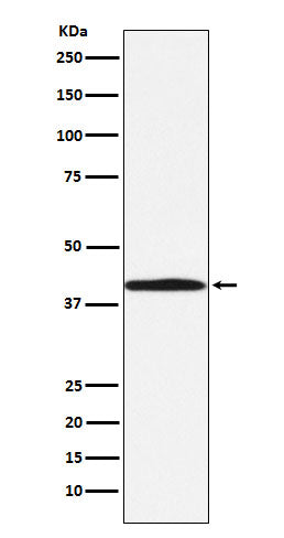 Anti-BGAT Rabbit Monoclonal Antibody Boster Bio