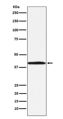 Anti-BGAT Rabbit Monoclonal Antibody Boster Bio