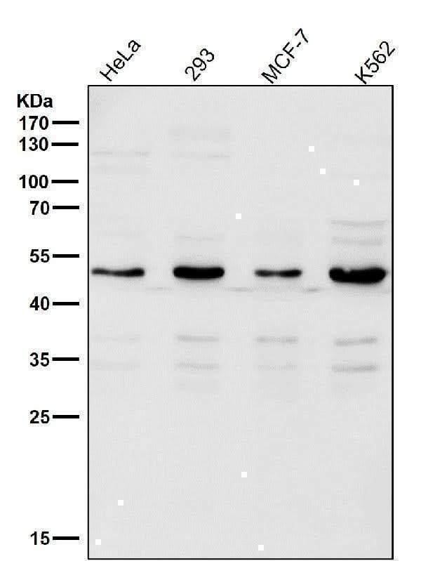 Anti-Lipoprotein lipase LPL Rabbit Monoclonal Antibody Boster Bio