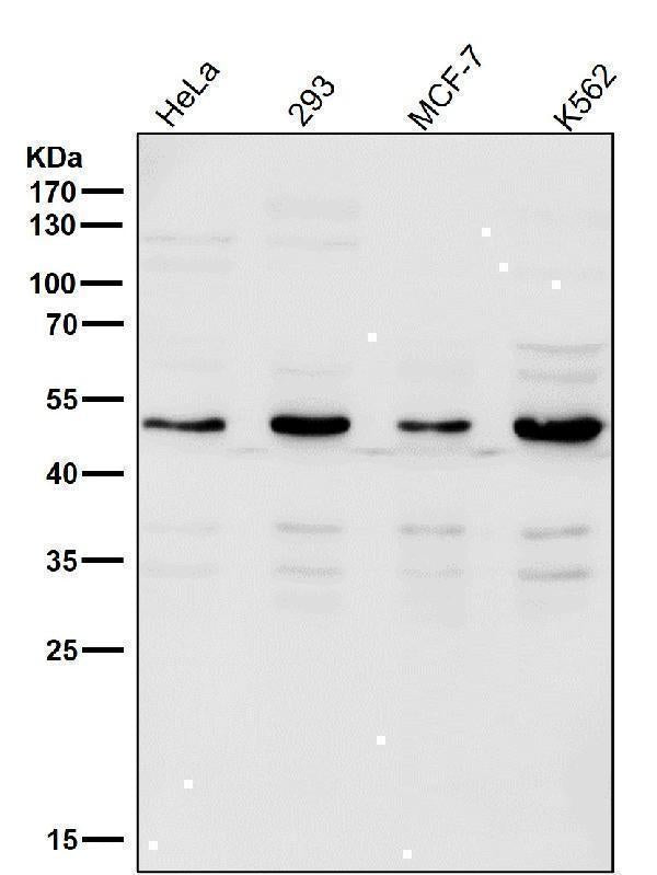Anti-Lipoprotein lipase LPL Rabbit Monoclonal Antibody Boster Bio