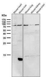 Anti-PI 3 Kinase p85 alpha PIK3R1 Rabbit Monoclonal Antibody Boster Bio