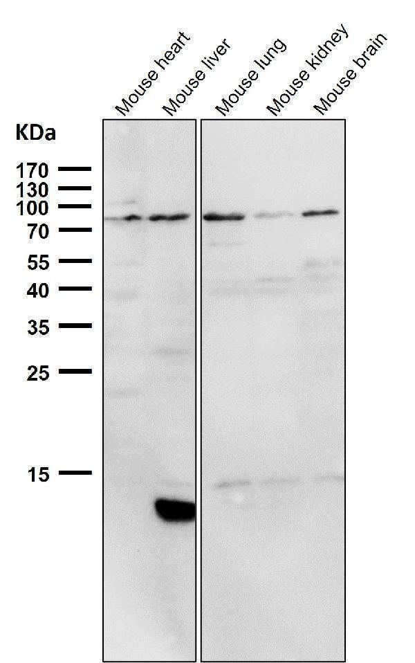 Anti-PI 3 Kinase p85 alpha PIK3R1 Rabbit Monoclonal Antibody Boster Bio