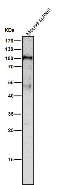 Anti-Dnmt3b Rabbit Monoclonal Antibody Rabbit Monoclonal Antibody Boster Bio