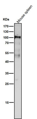Anti-Dnmt3b Rabbit Monoclonal Antibody Rabbit Monoclonal Antibody Boster Bio