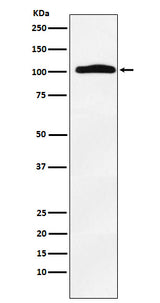 Anti-Thyroid Peroxidase Rabbit Monoclonal Antibody Boster Bio