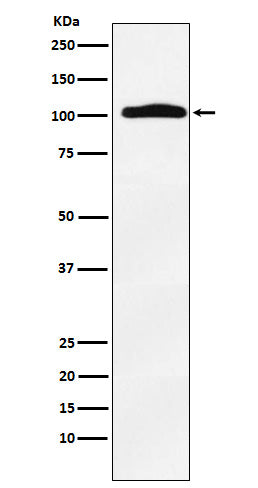 Anti-Thyroid Peroxidase Rabbit Monoclonal Antibody Boster Bio