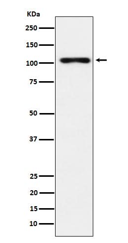 Anti-TPO Monoclonal Antibody Boster Bio