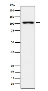 Anti-TPO Monoclonal Antibody Boster Bio