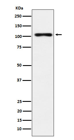 Anti-TPO Monoclonal Antibody Boster Bio