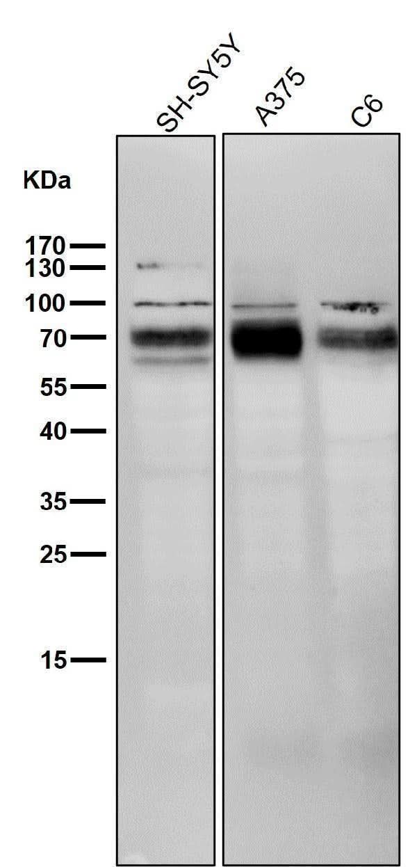 Anti-BACE1/Bace Rabbit Monoclonal Antibody Boster Bio